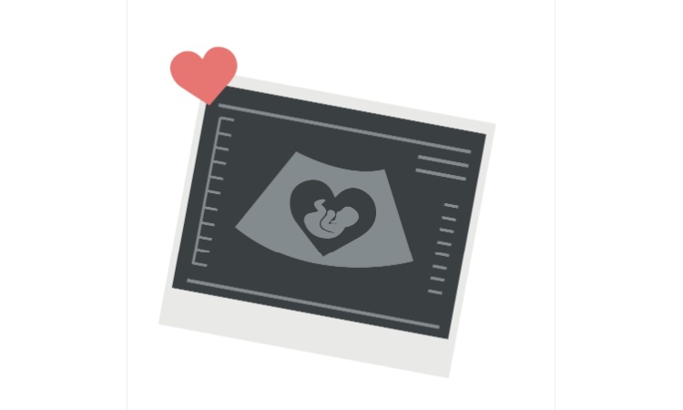 Antenatal scan Antenatal scan