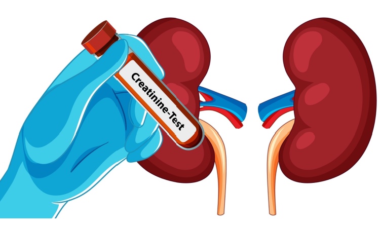 Causes Of High Creatinine Causes Of High Creatinine