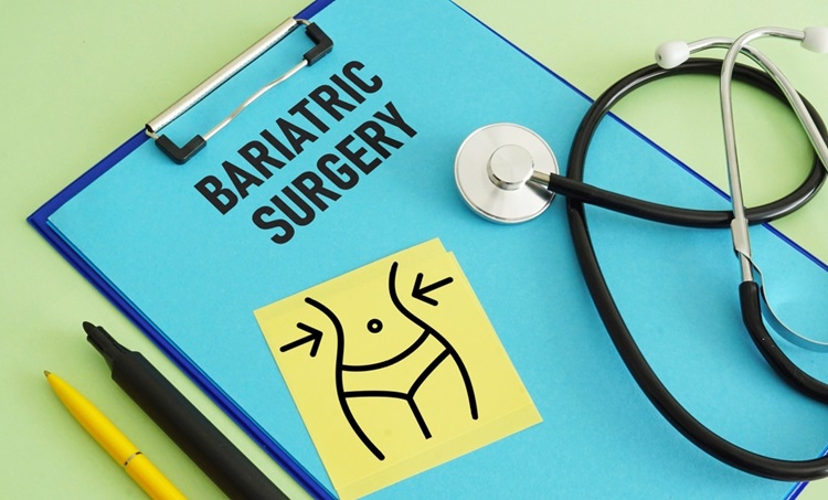 Does Health Insurance Cover Bariatric Surgery Does Health Insurance Cover Bariatric Surgery