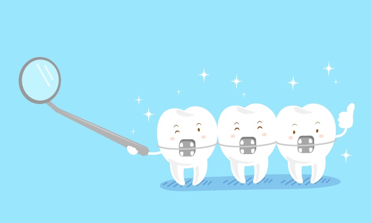 Does Your Health Insurance Cover Braces