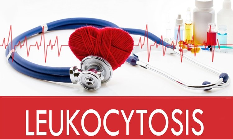 What Is Leukocytosis? What Is Leukocytosis?