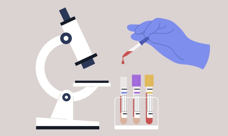 New Blood Test Detects Chronic Fatigue Syndrome