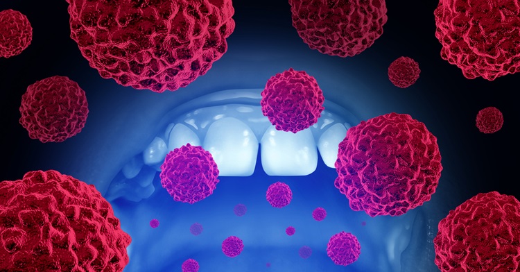 Oral cancer cost in india