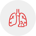 Primary (Idiopathic) Pulmonary Hypertension
