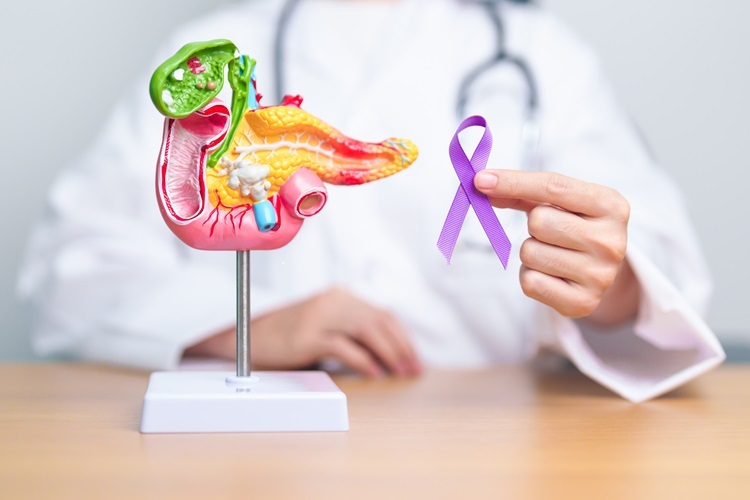 Prostrate Cancer Myths Prostrate Cancer Myths