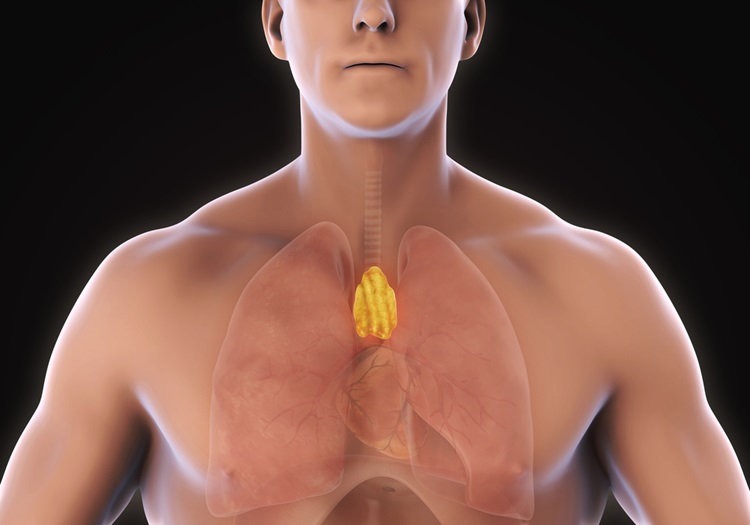 Thymus cancer Thymus cancer