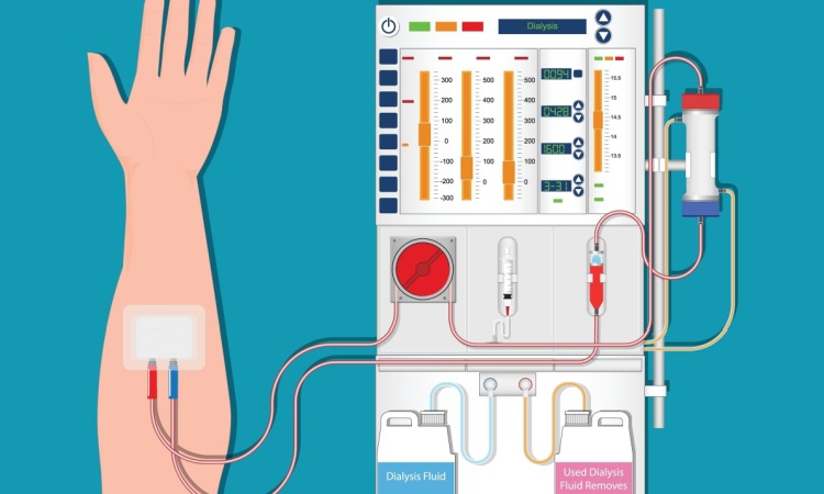 Types Of Dialysis Types Of Dialysis