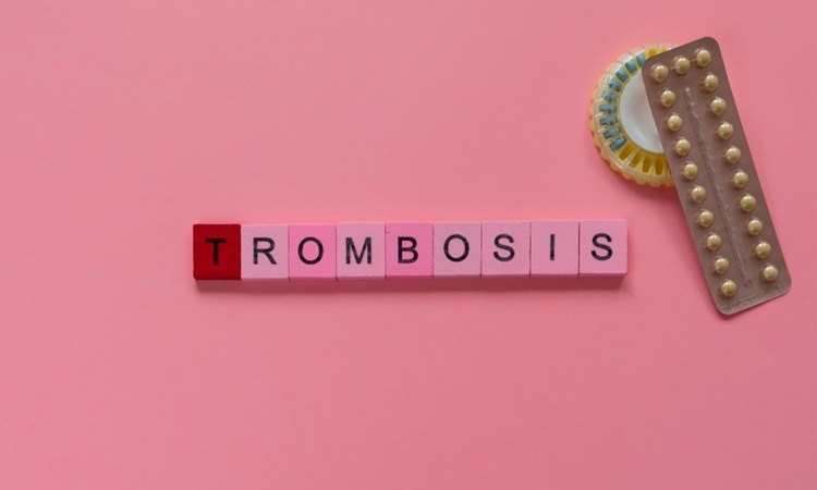 What are the causes of thrombosis? What are the causes of thrombosis?