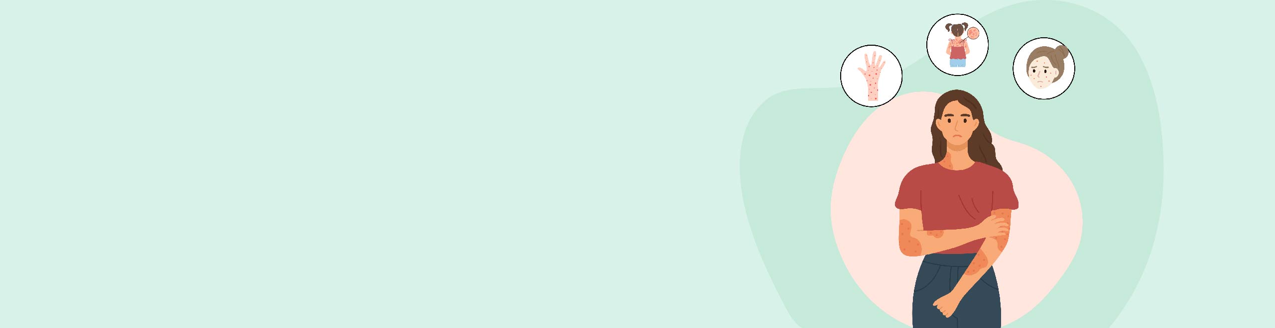 All About Skin Allergies