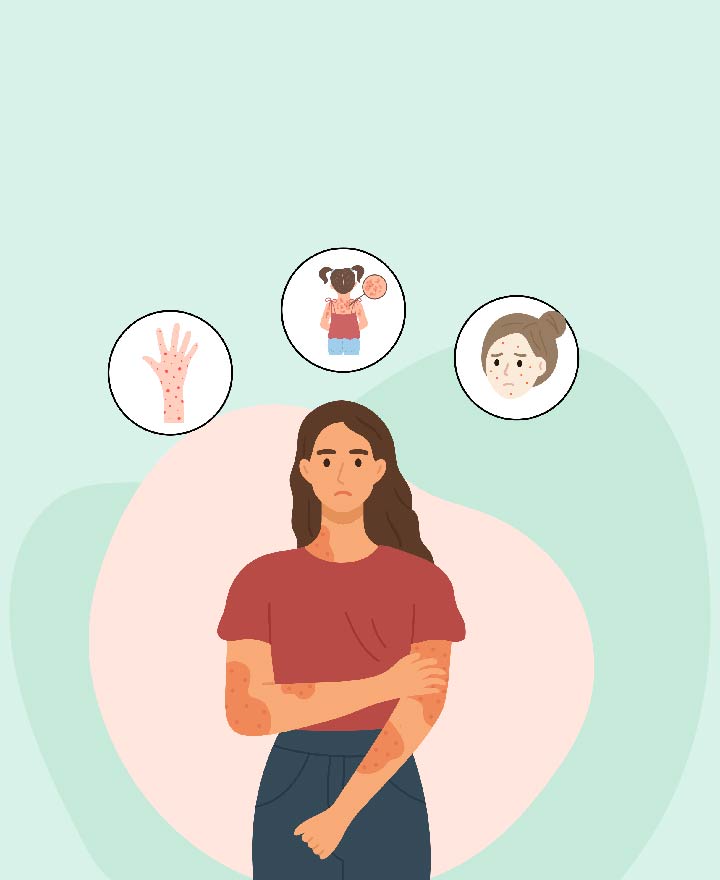 All About Skin Allergies