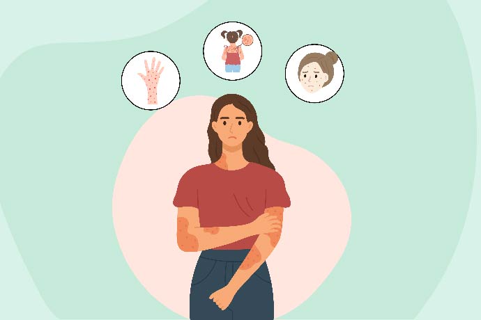 Skin allergy - types, causes, treatment