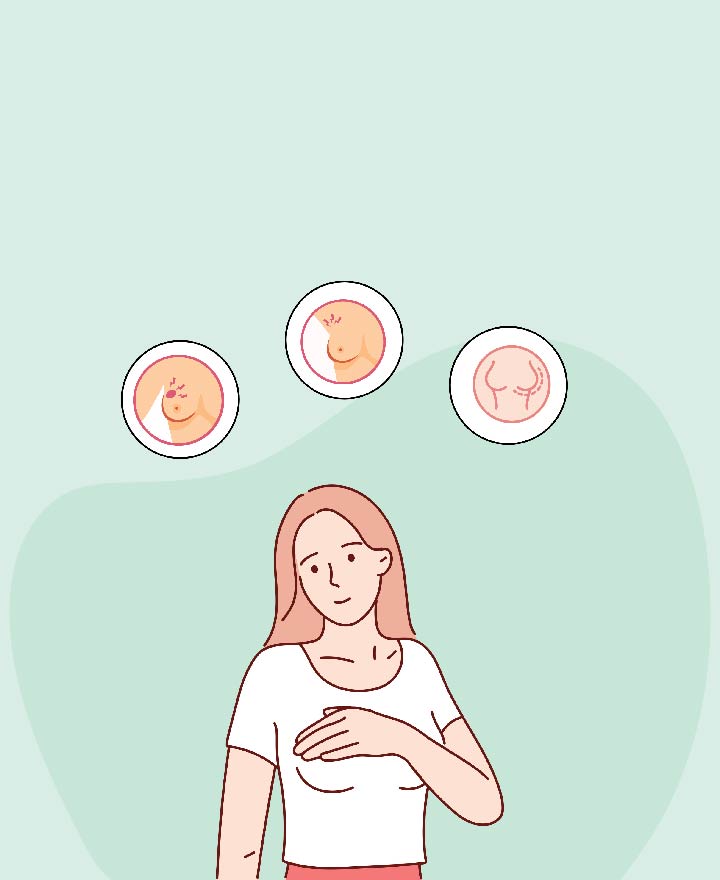 Symptoms and Signs of Breast Cancer