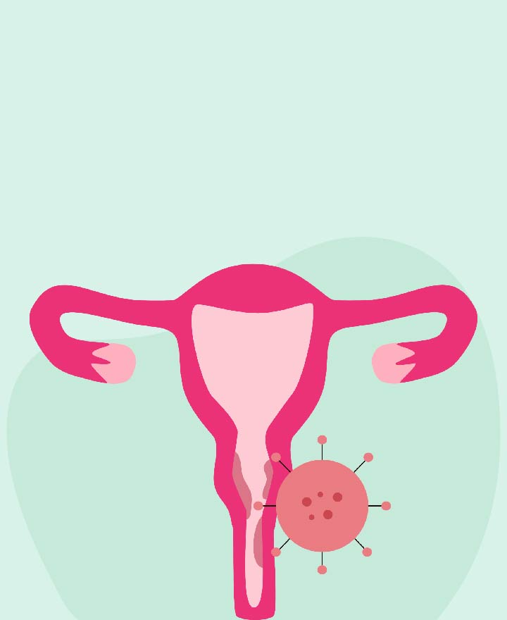Multiple Pregnancy