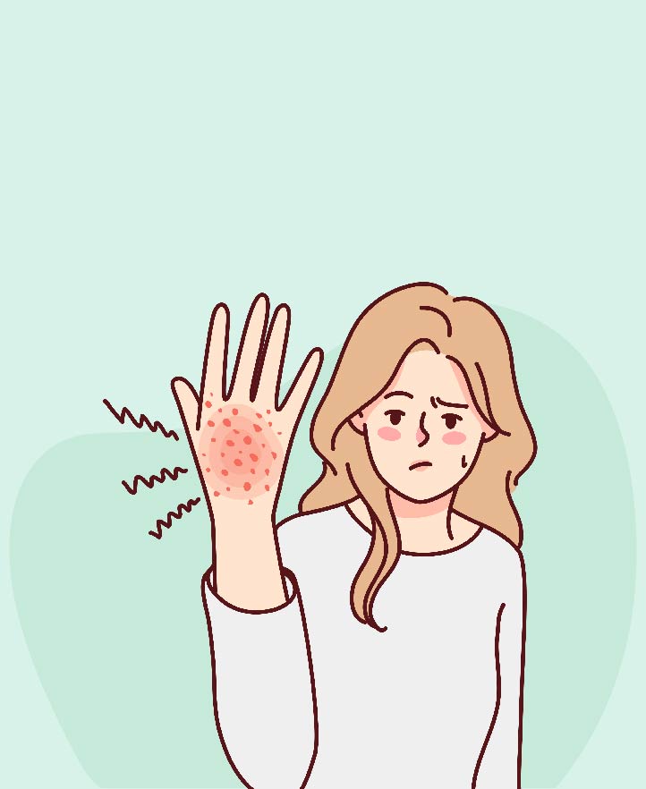 Fungal Infection: Symptoms, Causes & Treatment