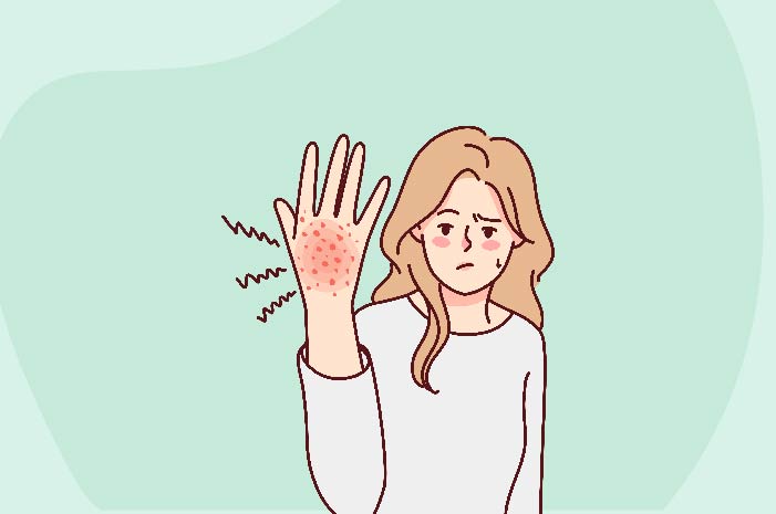 Symptoms, Causes & Treatment of Fungal Infection