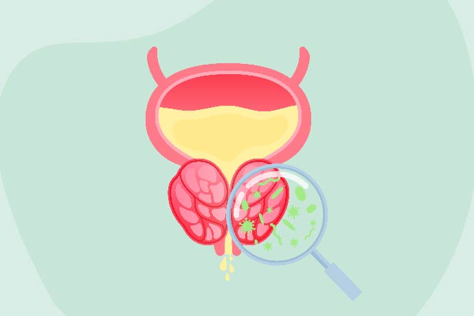 10 home remedies for UTI