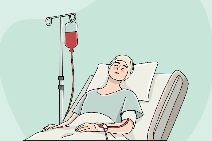 How is Chemotherapy Done? Process Explained