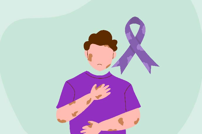 The Complete Guide To Leprosy Stigma 