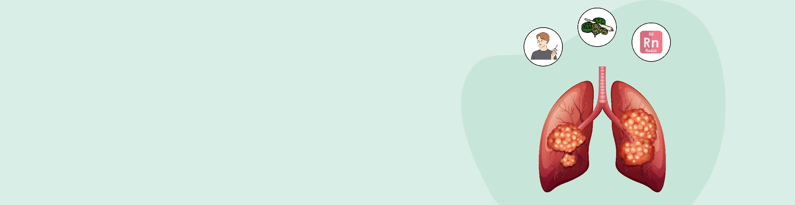What causes Lung Cancer?