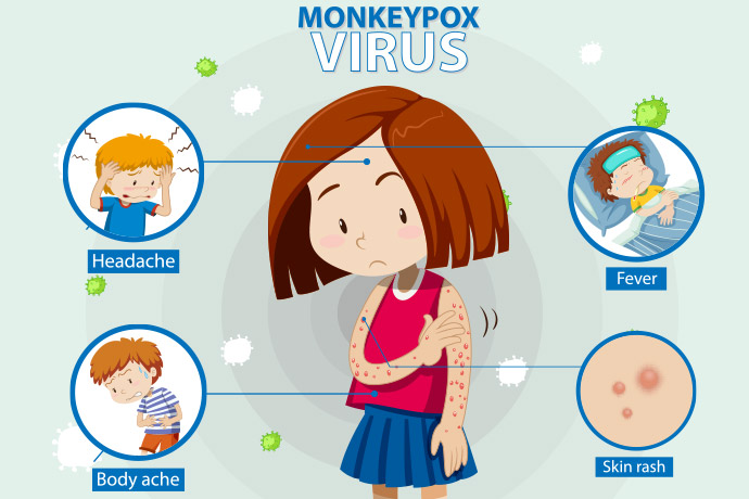 Everything You Need To Know About Monkeypox