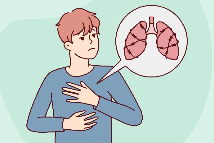 Pneumonia - symptoms & causes