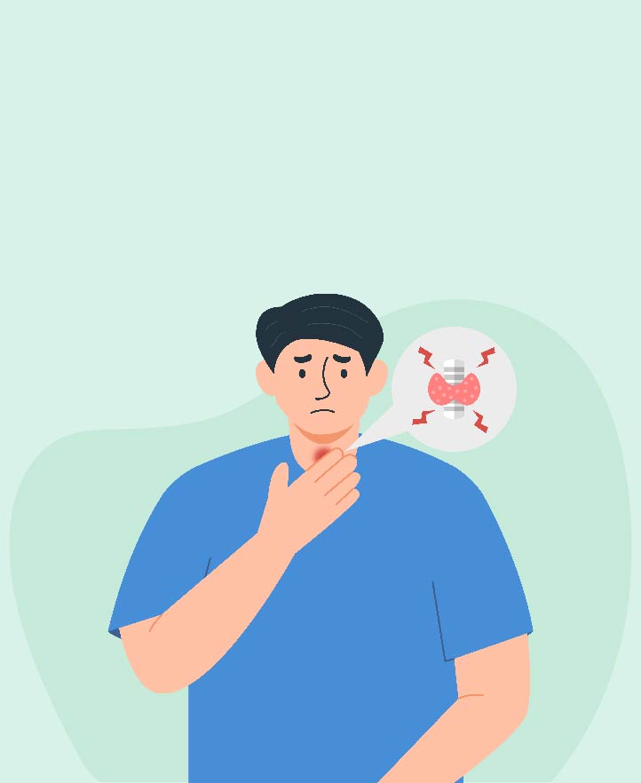 Hypothyroidism - Symptoms and causes