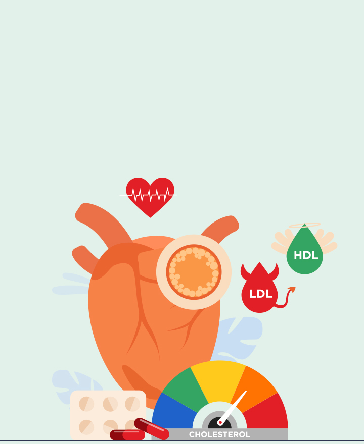 Types of Cholesterol Tests