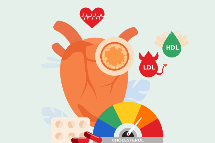 Types Of Cholesterol Tests – What You Should Know?