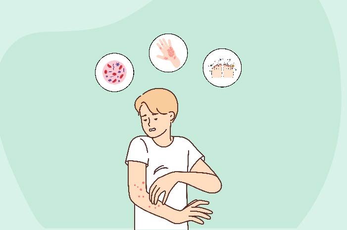What Are the Different Types of Fungal Infections? 